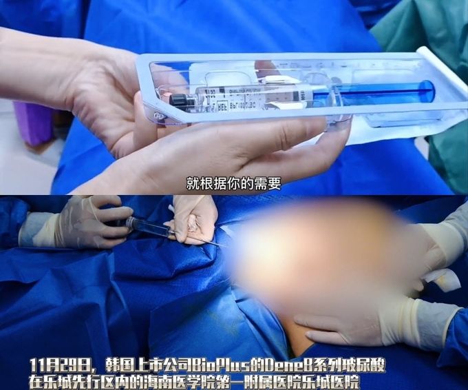 하이난 의료특구 관리국 홍보채널에 소개된 바이오플러스 DeneB(드네브) 시술 장면 ⓒ 파이낸셜데일리 / 바이오플러스