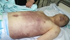 '윤 일병 사건' 가해병사 보강 수사…'살인죄' 적용하나?